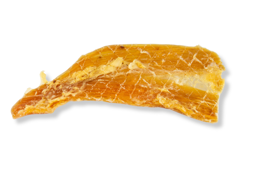 Nervo Cervical